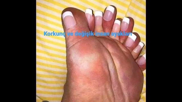 Değişik insan ayakları Değişik insan ayakları