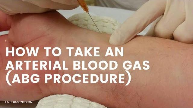 How to take blood for abg | radial artery How to take blood for abg | radial artery