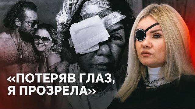 Читал переписки, избивал, оставил без глаза и уехал на «сво»: монолог о домашнем насилии Читал переписки, избивал, оставил без глаза и уехал на «сво»: монолог о домашнем насилии