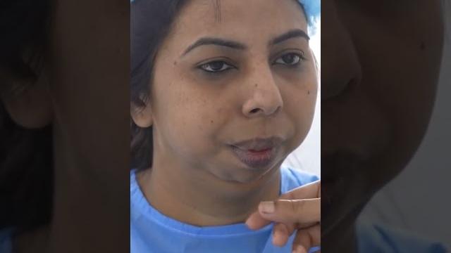 Jaw plastic surgery for young lady Jaw plastic surgery for young lady