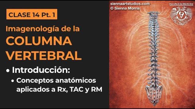 14.1 - imagenología de la columna vertebral: conceptos anatómicos aplicados a métodos de imagen 14.1 - imagenología de la columna vertebral: conceptos anatómicos aplicados a métodos de imagen