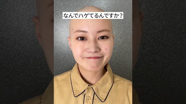 なんでハゲてるんですか? #脱毛症 なんでハゲてるんですか? #脱毛症