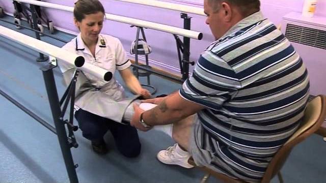 Leg amputation and life afterwards Leg amputation and life afterwards