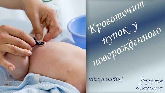 Что делать, если кровоточит пупок у новорожденного Что делать, если кровоточит пупок у новорожденного