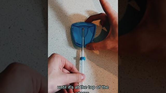 Iud insertion & iud removal (copper paragard, mirena) (part 2) Iud insertion & iud removal (copper paragard, mirena) (part 2)