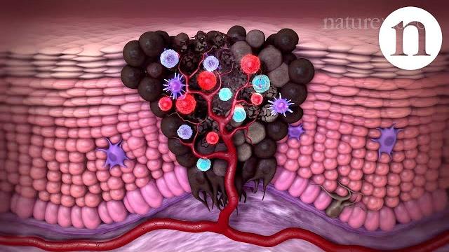 Tumour immunology and immunotherapy Tumour immunology and immunotherapy