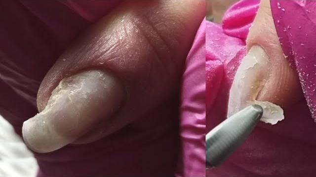 Из-за чего пустота под ногтем Из-за чего пустота под ногтем