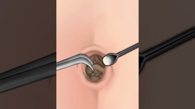 Asmr | navel stone belly button ring remove animation Asmr | navel stone belly button ring remove animation