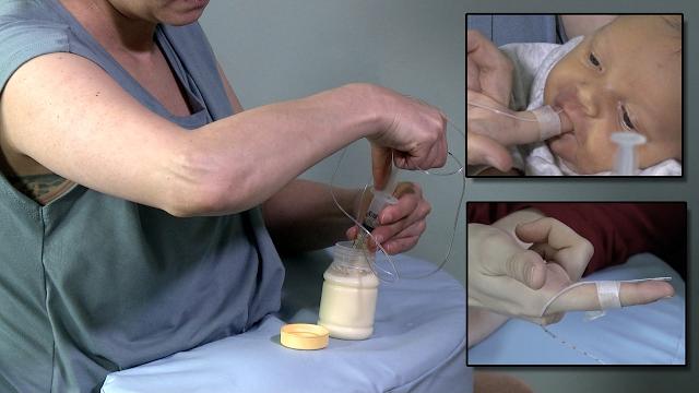 Finger feeding to supplement a breastfeeding infant Finger feeding to supplement a breastfeeding infant