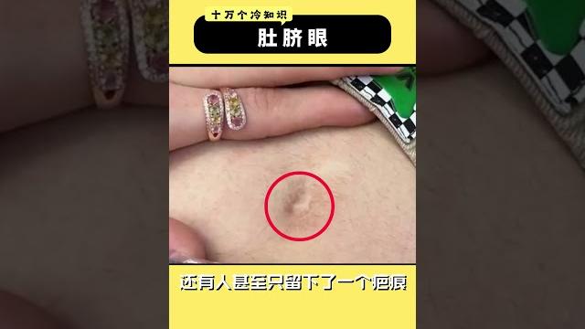 为什么不要抠肚脐? #冷知识 #科普 为什么不要抠肚脐? #冷知识 #科普