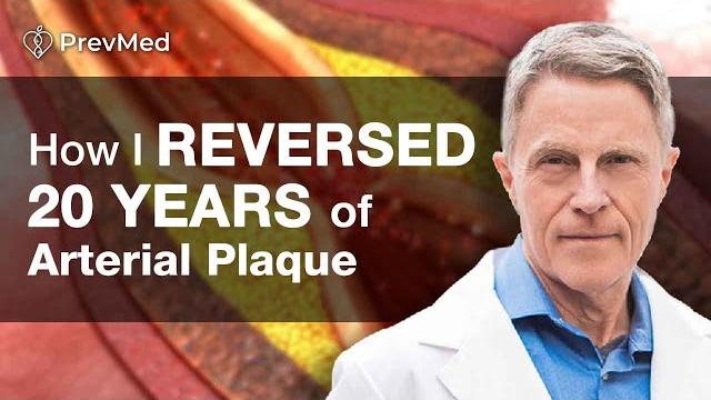 How i reversed 20 years of arterial plaque How i reversed 20 years of arterial plaque