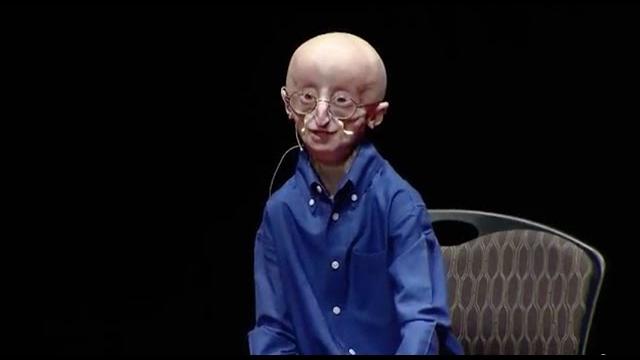 My philosophy for a happy life | sam berns | tedxmidatlantic My philosophy for a happy life | sam berns | tedxmidatlantic