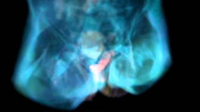 Sex under mri - anatomy of love, rate my science Sex under mri - anatomy of love, rate my science
