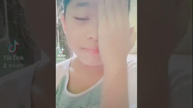 Kinoy bermetamorposis Kinoy bermetamorposis