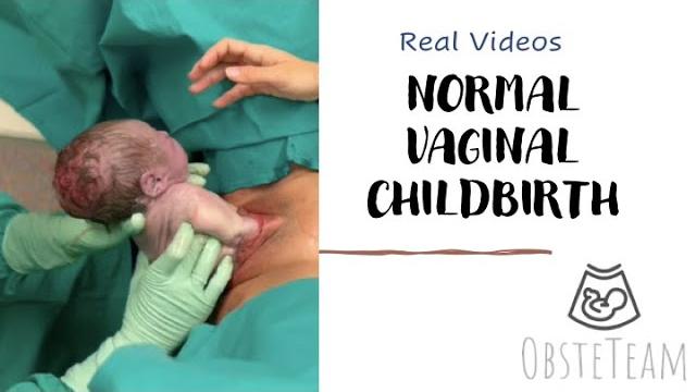 Normal vaginal childbirth Normal vaginal childbirth