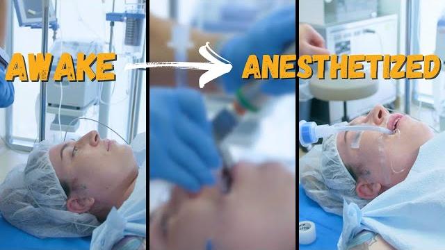 Going from awake to under general anesthesia Going from awake to under general anesthesia