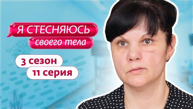 Я стесняюсь своего тела. россия | 3 сезон, 11 выпуск Я стесняюсь своего тела. россия | 3 сезон, 11 выпуск