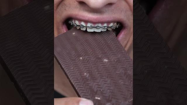 Mr. beast bars vs braces Mr. beast bars vs braces