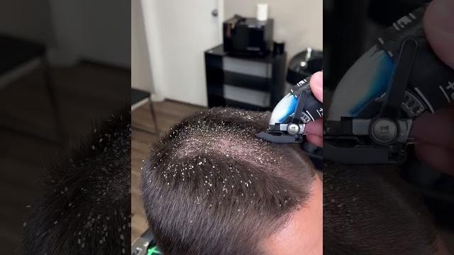 Barber cuts off lice!!!! must watch Barber cuts off lice!!!! must watch