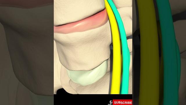 Sciatic nerve pain - sciatica pathophysiology, causes and treatment Sciatic nerve pain - sciatica pathophysiology, causes and treatment