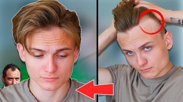 Лучшая стрижка при залысинах |как скрыть мужские залысины?! укладка тонких и редких волос 2022 Лучшая стрижка при залысинах |как скрыть мужские залысины?! укладка тонких и редких волос 2022