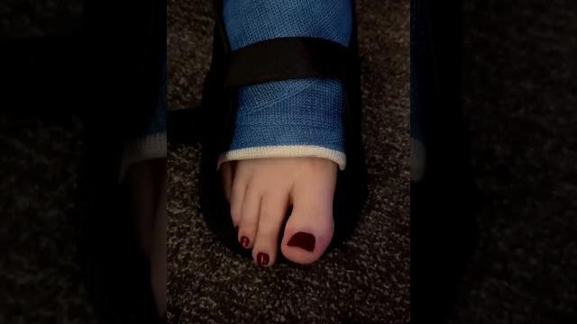 Nude foot beauty & plaster bandage aesthetic | soft & real summer pedicure vibes #chictoes #foot Nude foot beauty & plaster bandage aesthetic | soft & real summer pedicure vibes #chictoes #foot