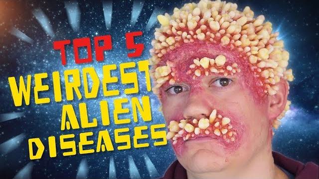 Top 5 weirdest alien diseases Top 5 weirdest alien diseases