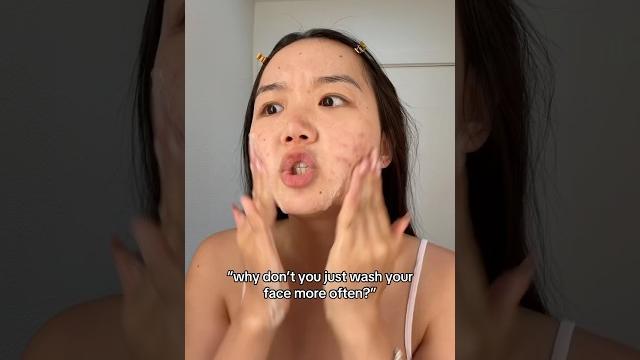 I wish it was that easy #acne #relatable #clearskin I wish it was that easy #acne #relatable #clearskin