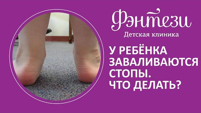 У ребёнка заваливаются стопы что делать У ребёнка заваливаются стопы что делать