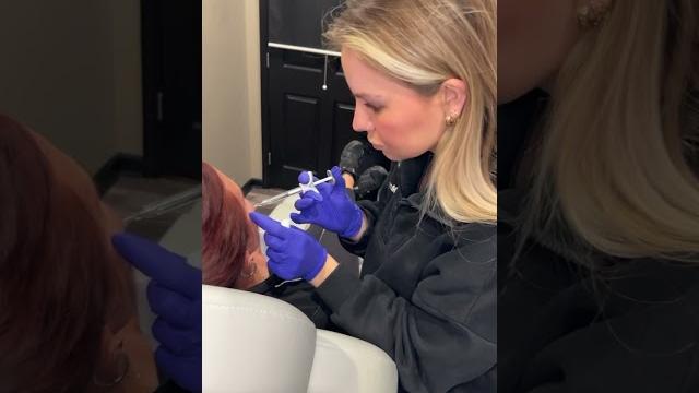 Girl, get the cheek filler! Girl, get the cheek filler!