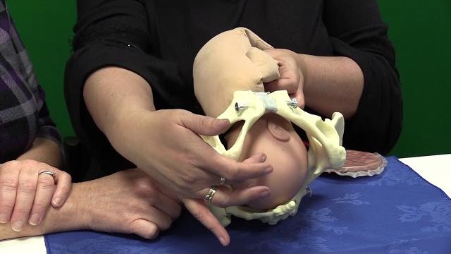 Mechanism of normal labour Mechanism of normal labour
