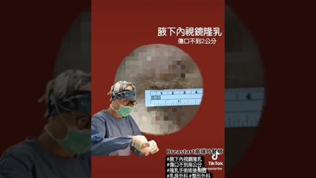 腋下內視鏡傷口多大?不到兩公分ft 高瑞吟醫師 腋下內視鏡傷口多大?不到兩公分ft 高瑞吟醫師