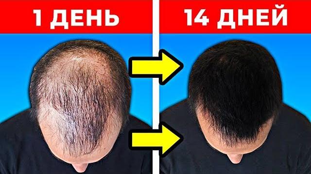 10 способов как быстро отрастить волосы 10 способов как быстро отрастить волосы
