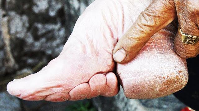 The horrors behind foot binding The horrors behind foot binding