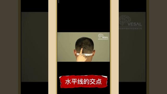 玉枕穴 英文名:yuzhen 足太阳膀胱经 bl 9 玉枕穴 英文名:yuzhen 足太阳膀胱经 bl 9