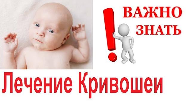 Лечение кривошеи. как носить ребенка при кривошее Лечение кривошеи. как носить ребенка при кривошее