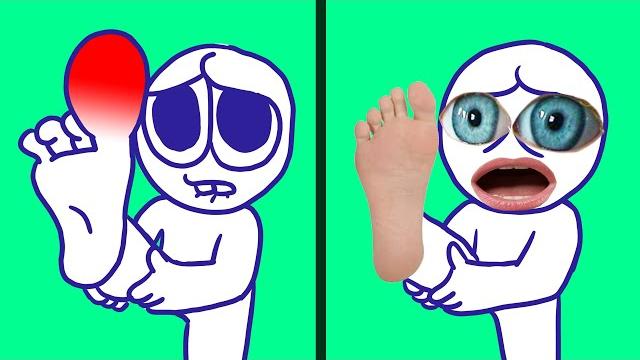 Cartoon vs reality Cartoon vs reality