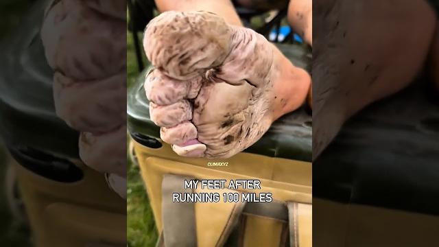 Feet after 200km of marathon (@brockcovington) Feet after 200km of marathon (@brockcovington)
