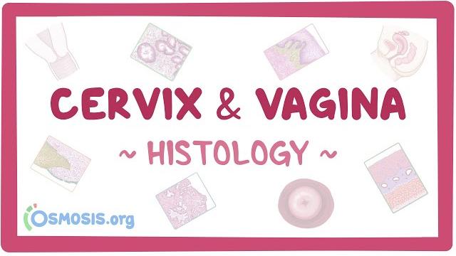 Cervix and vagina: histology Cervix and vagina: histology