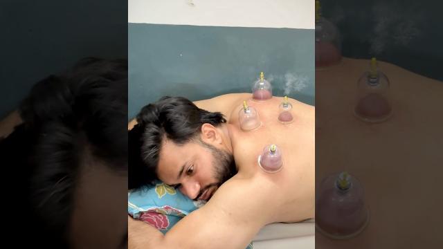 Hijama therepy #altamashhusainn #motivation #fitness #bodybuilding #desi #viralvideo #trending Hijama therepy #altamashhusainn #motivation #fitness #bodybuilding #desi #viralvideo #trending
