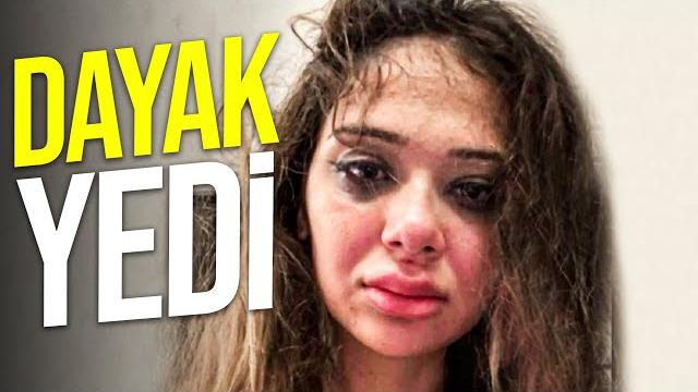 Merve taşkin'in dövülmesi̇ Merve taşkin'in dövülmesi̇