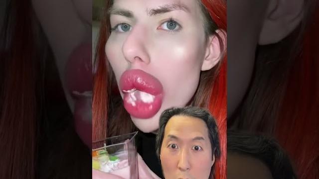 Can’t stop watching those lips! #shorts #asmr #lipinjections Can’t stop watching those lips! #shorts #asmr #lipinjections