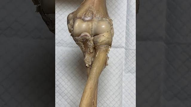 Elbow joint Elbow joint