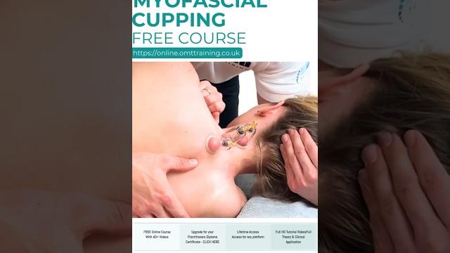 How to treat neck pain using myofascial cupping with #mobilisation #osteopathy #cupping #neckpain How to treat neck pain using myofascial cupping with #mobilisation #osteopathy #cupping #neckpain