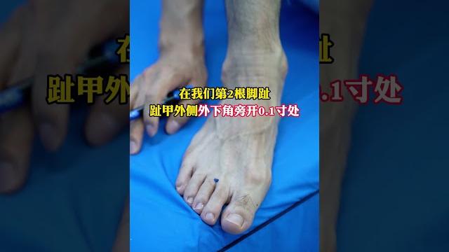 经常上火牙疼,记住3个穴位 #上火 #牙疼 #穴位按摩 #中医 经常上火牙疼,记住3个穴位 #上火 #牙疼 #穴位按摩 #中医