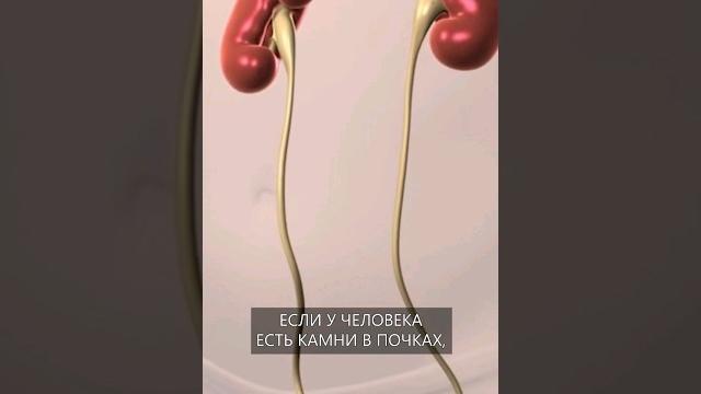 Самая сильная в мире боль Самая сильная в мире боль