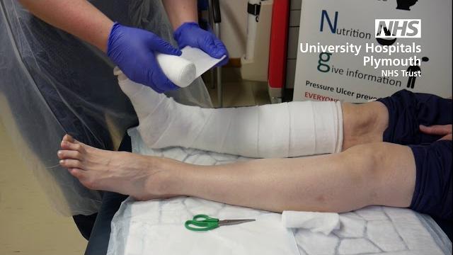 How to apply a simple bandage How to apply a simple bandage