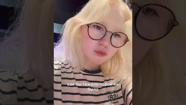 Альбинизм лечится ? #альбинизм #альбинос Альбинизм лечится ? #альбинизм #альбинос