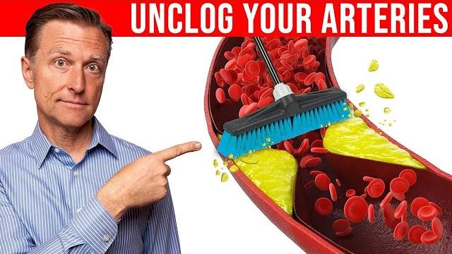 The #1 best remedy to clean plaque from your arteries The #1 best remedy to clean plaque from your arteries