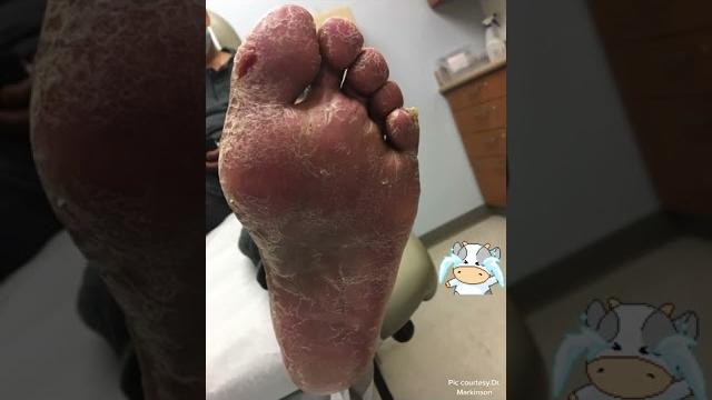 Foot doctor to the rescue Foot doctor to the rescue